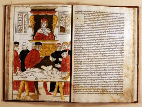 Coloured xilograph that shows for the first time the operation of a corpse dissection, 1493-1494. Creator: Johan Ketham (1415-1470).