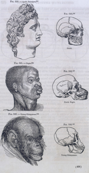 Three faces compared with skulls, 1854. 'Fig. 339. - Apollo Belvidere; Fig. 340. Greek; Fig. 341. -