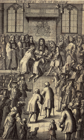 'The Royal Gift of Healing', King Charles II healing the sick, 1684. It was believed that the royal