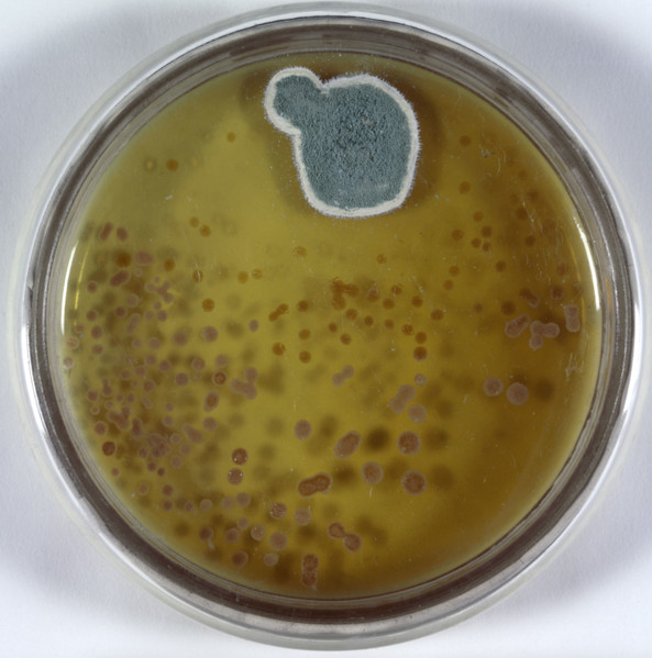 Model of culture dish and Penicillin mould. In 1928, while carrying out research into influenza,