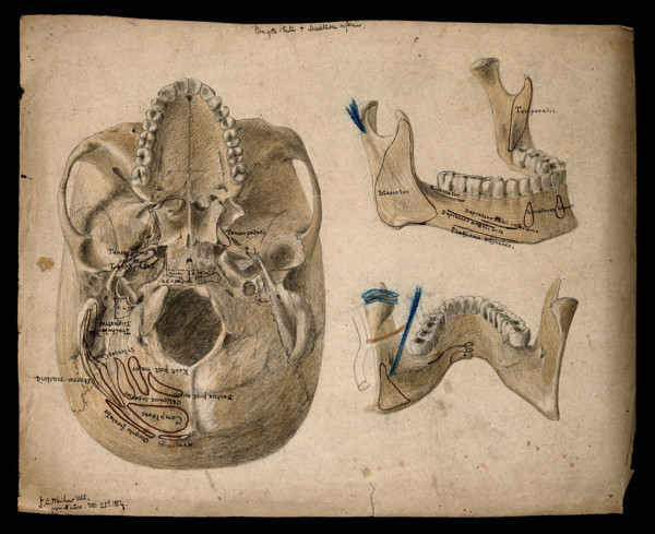 Base of the skull, with details showing the lower jaw, 1854/02/25. Creator: J.C. Whishaw.