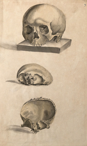 Human skull: three figures showing sections and an entire skull, 1830-1835. Creator: Unknown.