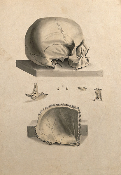 Human skull: six figures showing sections and an entire skull, 1830-1835. Creator: Unknown.