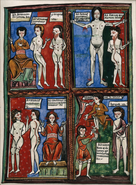 Four vignettes demonstrating different cauterisation points on naked human bodies. Creator: Unknown.