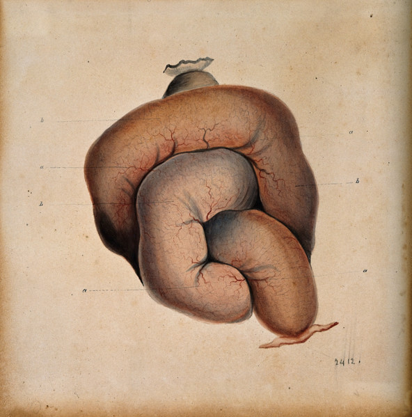 A length of coiled intestine, 1800-1899. Creator: Unknown.