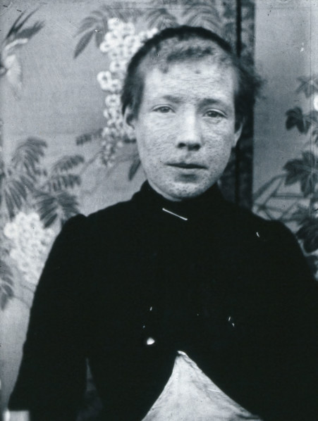 Gloucester smallpox epidemic, 1896: Ethel Cromwell, aged about 14 years, as a smallpox patient, 1896 Creator: HCF of Gloucester.