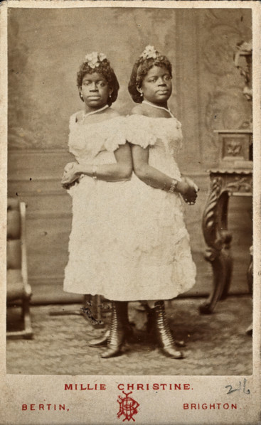 The Millie-Christine sisters, conjoined twins, standing, 1874. Creator: Bertin.