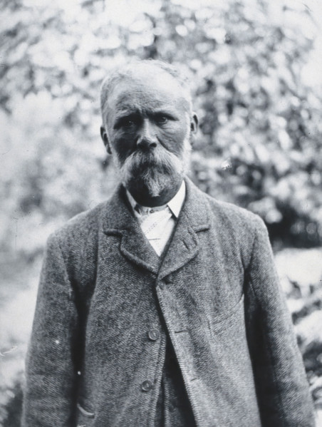 Gloucester smallpox epidemic, 1896: George Steel, a smallpox patient, 1896. Creator: HCF of Gloucester.
