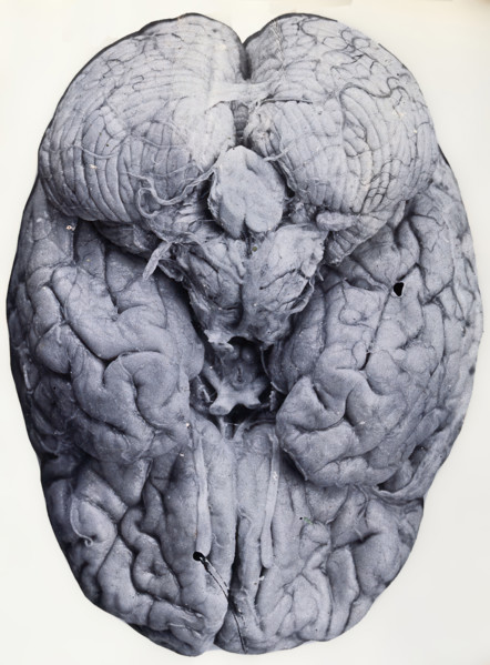 Friern Hospital, London: a brain, 1890-1910. Creator: Unknown.