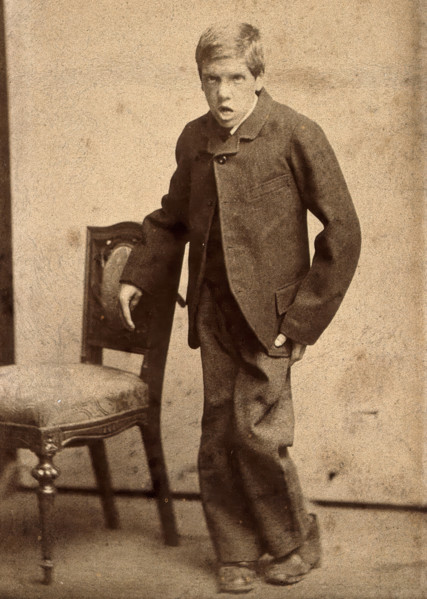 A young man, showing signs of mental deficiency, leaning awkwardly..., c1890s. Creator: Davis.