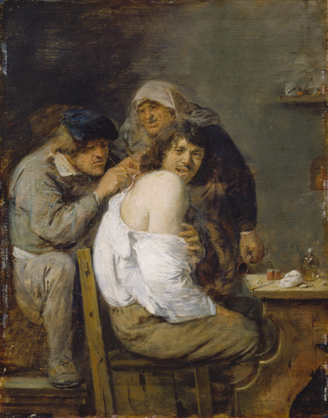 The Back Operation, c1636. Creator: Adriaen Brouwer.