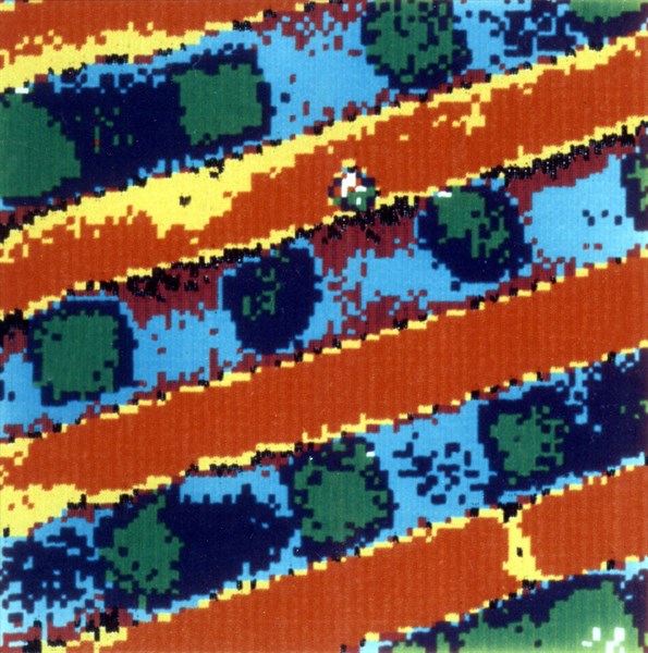 Image photoacoustique