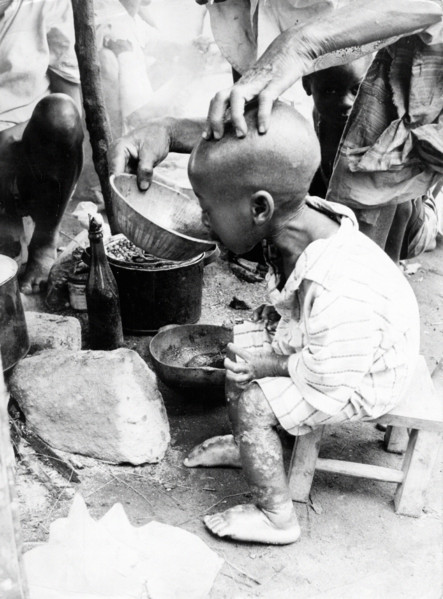 Enfant sous-alimenté au Biafra, 1969