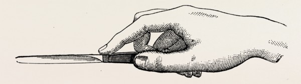 an incision, medical equipment, surgical instrument, history of medicine