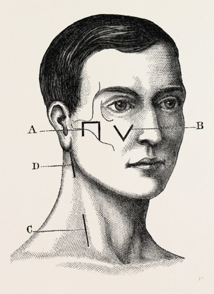a neurotomy of third division, medical equipment, surgical instrument, history of medicine