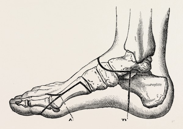 disarticulation of the great toe, medical equipment, surgical instrument, history of medicine
