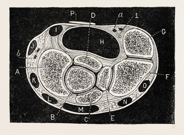 section through, medical equipment, surgical instrument, history of medicine