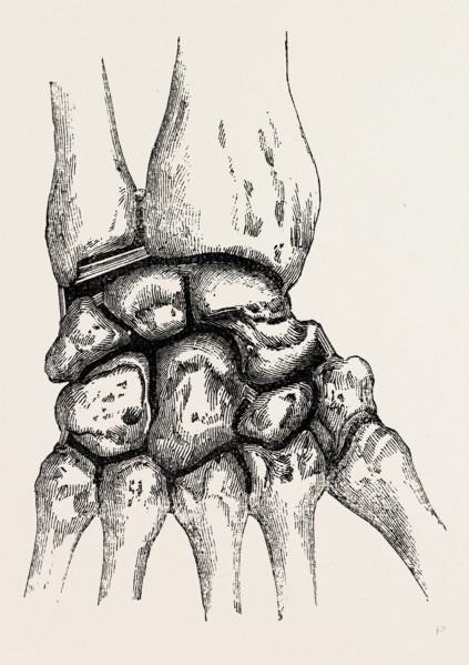 the synovial cavities, medical equipment, surgical instrument, history of medicine
