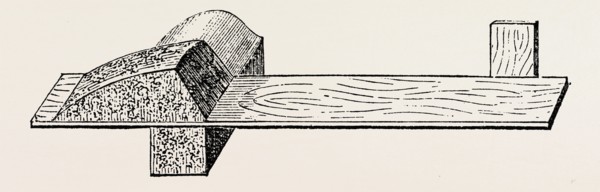 lister' s splint for excision, medical equipment, surgical instrument, history of medicine
