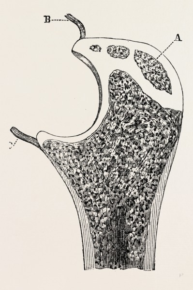 end of the ulna, medical equipment, surgical instrument, history of medicine