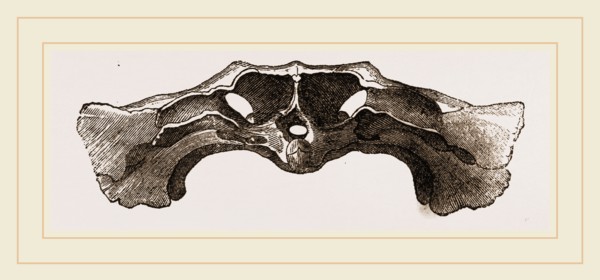 Skull of Matamata back view