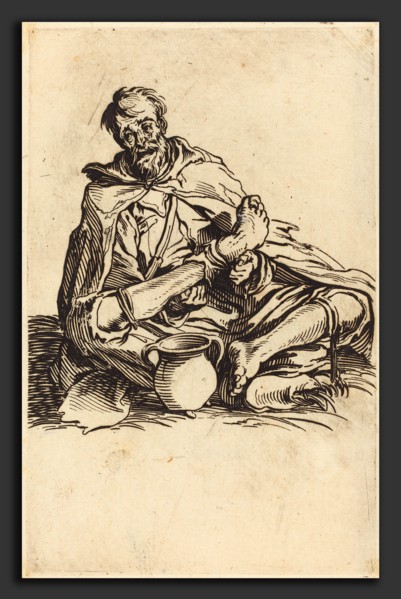 Jacques Callot (French, 1592 - 1635), The Sick Man, c. 1622, etching