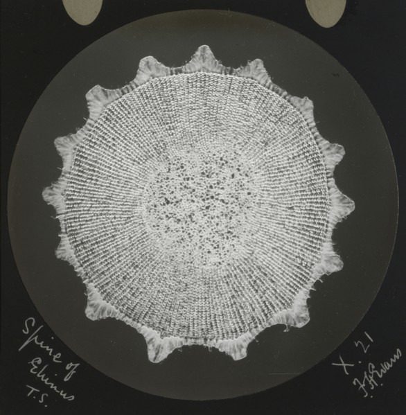 Spine of Ehinus; Frederick H. Evans, British, 1853 - 1943, 1890 - 1899; Lantern slide; 7.1 x 7.1 cm 2 13,16 x 2 13,16 in