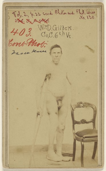 W. D. Gilbert Co, C. 6th Vt. Civil War Victim; American; 1865; Albumen silver print
