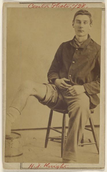 W.J. Knight Civil War victim; Attributed to William H. Bell, American, 1830 - 1910, about 1865; Albumen silver print