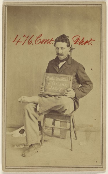Wesley Walters, Civil War victim; Attributed to William H. Bell, American, 1830 - 1910, about 1864; Albumen silver print