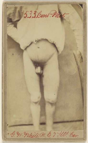Geo. W. White Pri. Co. E. 7. Ill. Cav. age 25...Civil War victim; Attributed to William H. Bell, American, 1830 - 1910, April