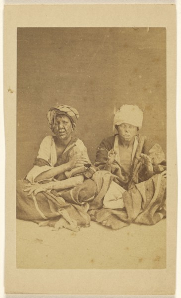 Lepreux a Jerusalem; Wilhelm Hammerschmidt, German, born Prussia, died 1869, 1865 - 1870; Albumen silver print