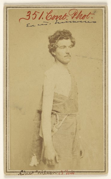 Chas. Wilson Civil War victim; Baldwin & Prior, American, 1865 - 1867, 1865 - 1867; Albumen silver print