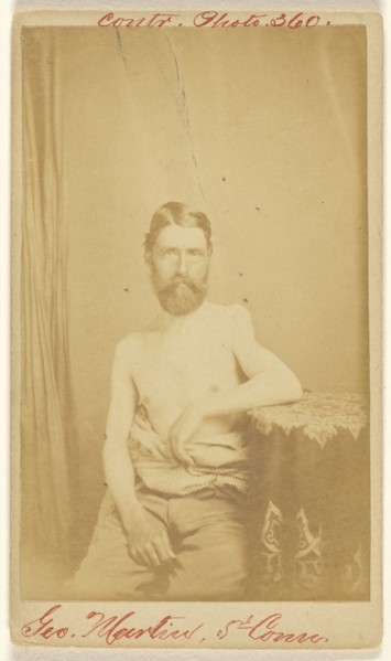 Geo. Martin, 5th Conn. Civil War victim; S. Friedlaender, American, active 1860s, 1864 - 1866; Albumen silver print