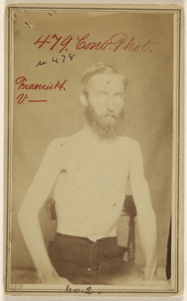 Frances H. V - Civil War victim; W.E. Whitehead, American, active 1860s, 1862 - 1864; Albumen silver print