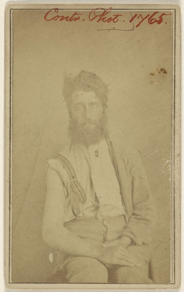 Civil War victim, seated; American; 1865 - 1870; Albumen silver print