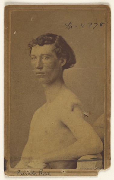 Private Ross Civil War victim; Attributed to William H. Bell, American, 1830 - 1910, 1865-1874; Albumen silver print