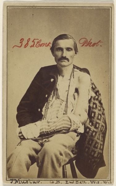 J. Mustar. Co B. Ind Batt. Wis. Vols. Civil War victim; American; 1865 - 1874; Albumen silver print