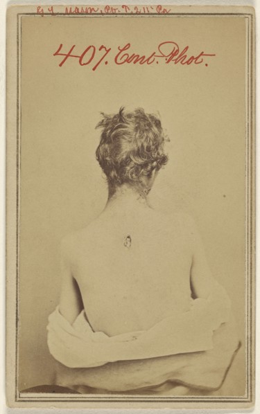 G.L. Mason, Pv. F. 211 Pa. Civil War victim; American; about 1865; Albumen silver print