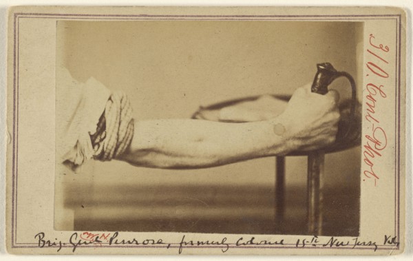 Excision of radius of Brig. Genl. Penrose, formerly Colonel 15th New Jersey Vols; Kennedy & Schenck; about 1865; Albumen silver