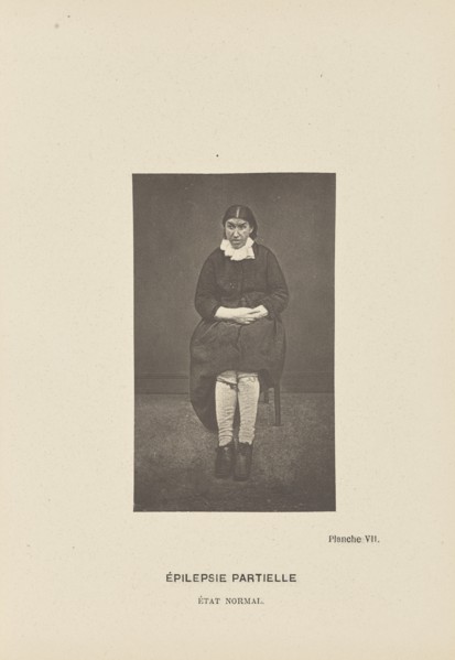 Épilepsie Partielle État Normal; Paul-Marie-Léon Regnard, French, 1850 - 1927, Paris, France; 1878; Photogravure; 10.2 × 6.1 cm