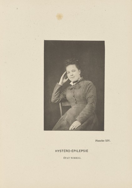 Hystéro-Épilepsie État Normal; Paul-Marie-Léon Regnard, French, 1850 - 1927, Paris, France; 1878; Photogravure; 9.5 × 6.4 cm