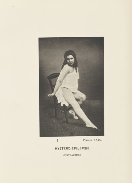 Hystéro-Épilepsie Contracture; Paul-Marie-Léon Regnard, French, 1850 - 1927, Paris, France; 1878; Photogravure; 10.6 × 6.9 cm