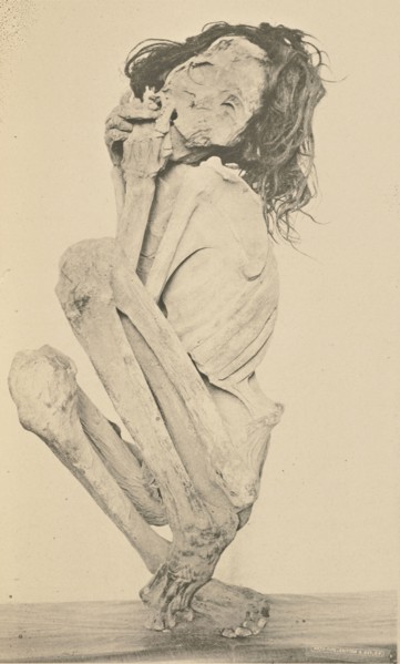 Remains of a Woman; Winfield S. Keyes, American, 1839 - 1906, Sacramento, California, United States; 1888; Artotype