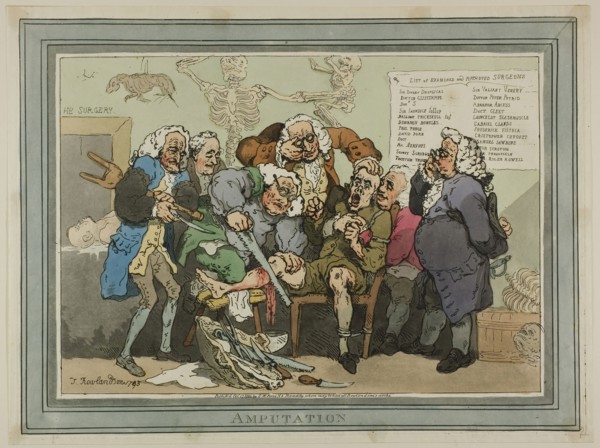 Amputation, published October 17, 1793, Thomas Rowlandson (English, 1756-1827), Published by S.W.