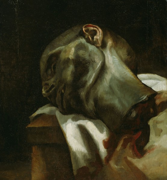 Head of a Guillotined Man, 1818/19, Jean Louis André Théodore Géricault, French, 1791-1824, France,