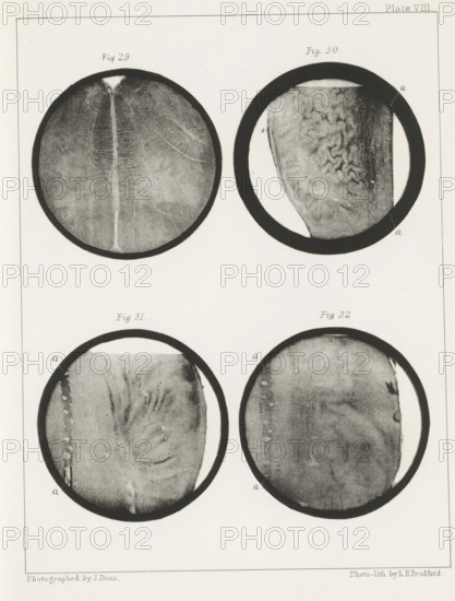 Four longitudinal and transverse sections of a human medulla oblongata, page, photomechanical