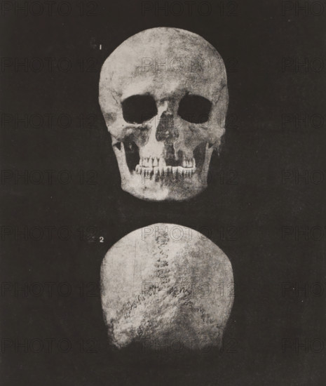 Two views of a human skull, front view and back view, 1. TÊTE HUMAINE FACE, 2. IDEM OCCIPUT VOIR PL