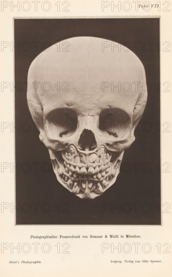 Children's skull with alternating teeth, page, photomechanical print, number: 'Tafel VII.', cliché
