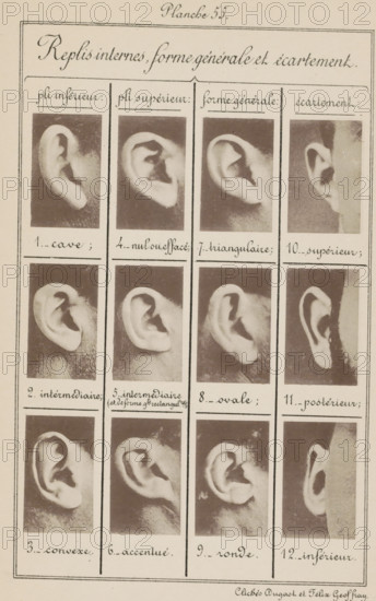 Replis interns, forme générale et écartement, Twelve images of ears, arranged by shape and width,